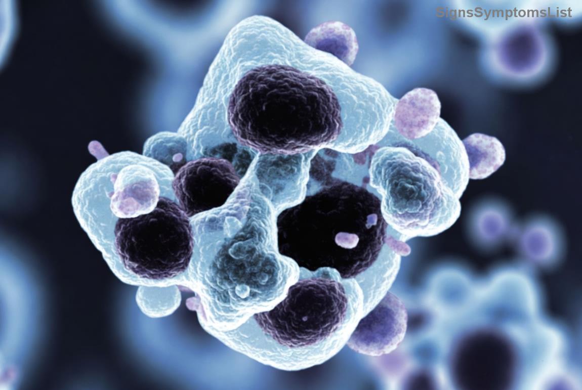 Moderne Therapien gegen Nierenkrebs: Immuntherapie und Medikamente