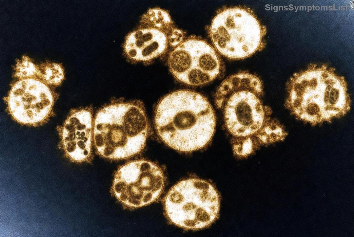 대장암 환자 영양 관리 이미지