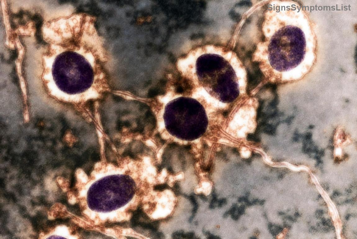 Patient recovering positively after prostate cancer treatment