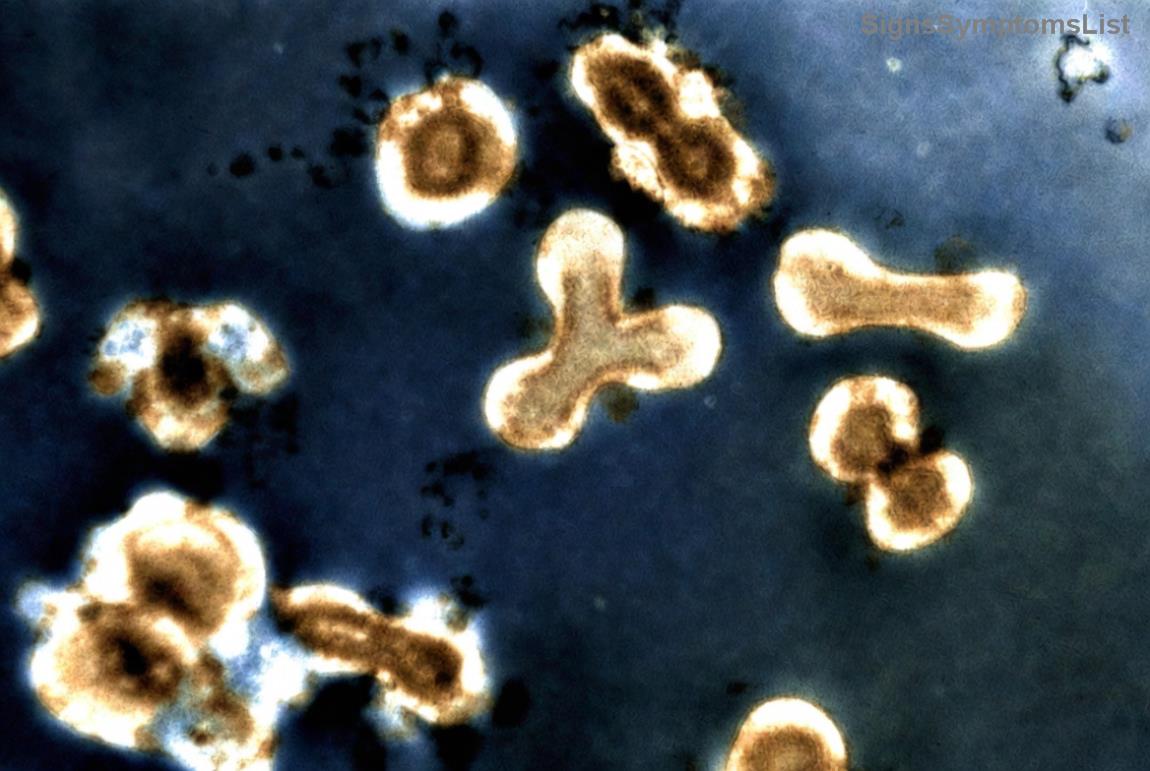 Patiënt met positieve uitkomst na immunotherapie voor melanoma