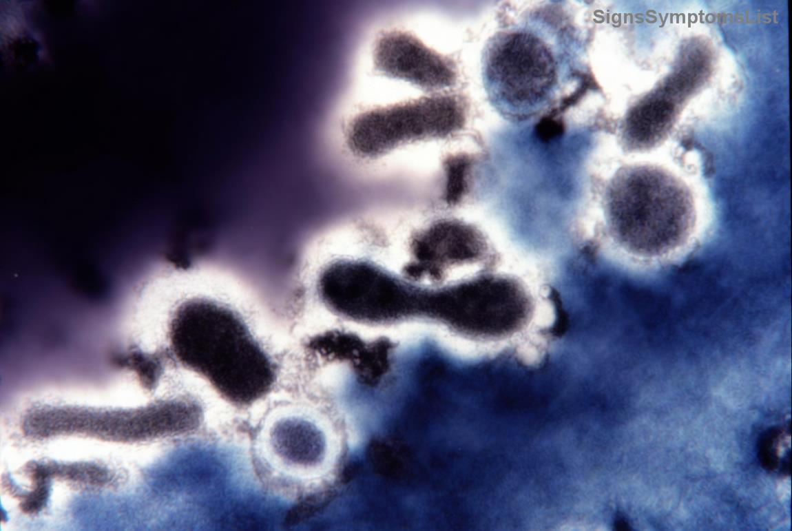 Modern treatments for kidney cancer