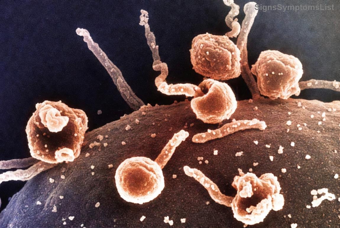 肾癌幸存者健康饮食概念图