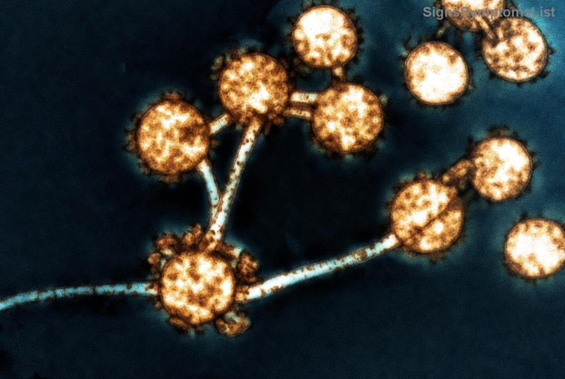 자궁경부암 치료 과정 이미지