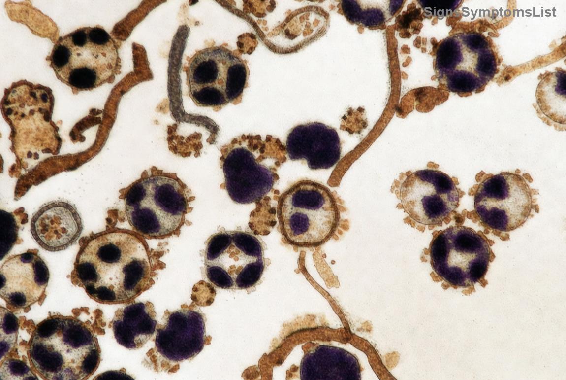 Patient receiving advanced breast cancer treatment in a modern clinic