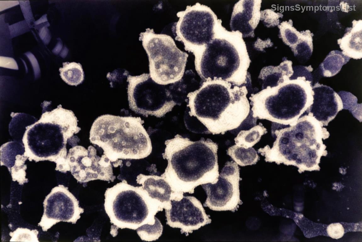 Green tea and turmeric as supportive superfoods in breast cancer diet