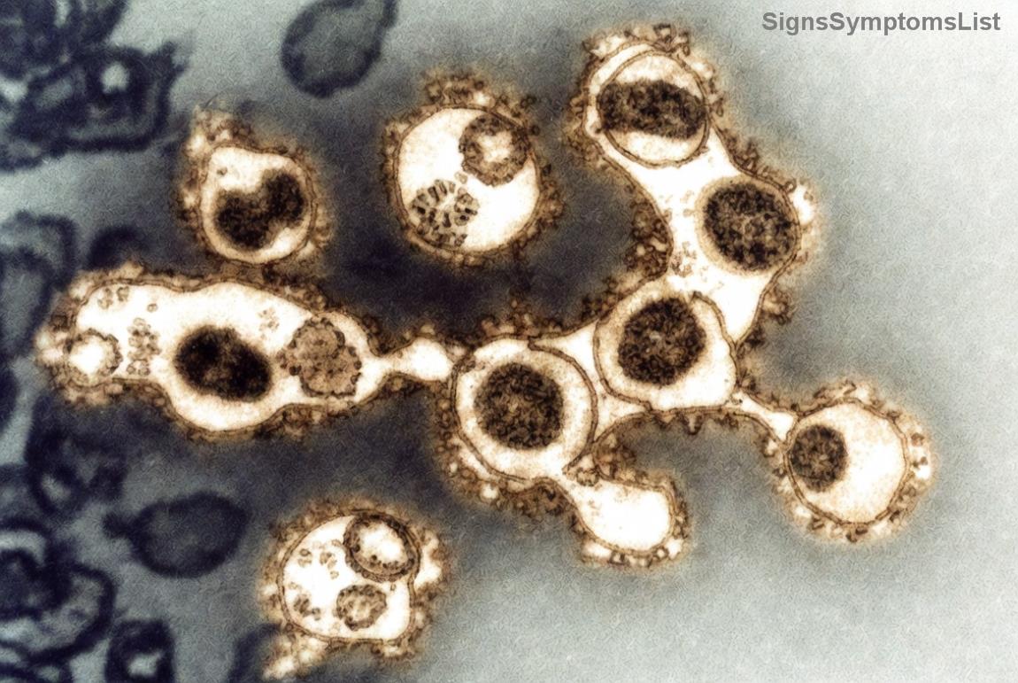 Patients en rémission d'un cancer colorectal