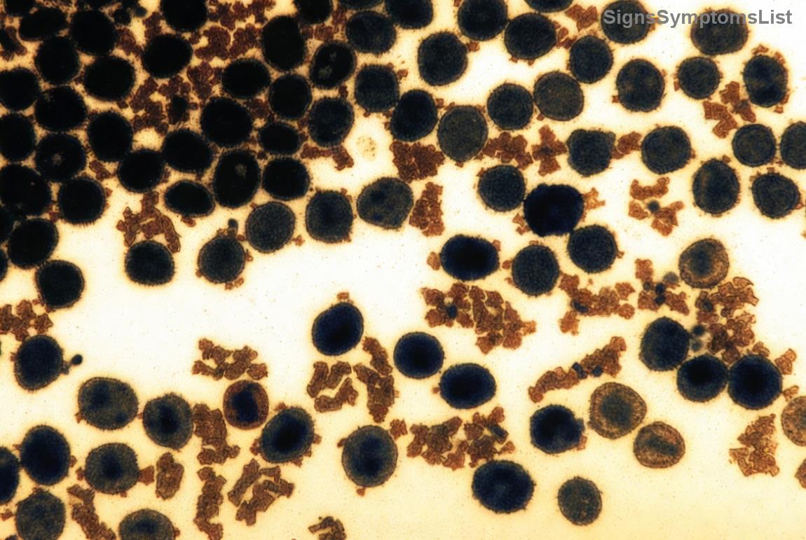 Afbeelding van hersenstructuur en ondersteuning bij kanker