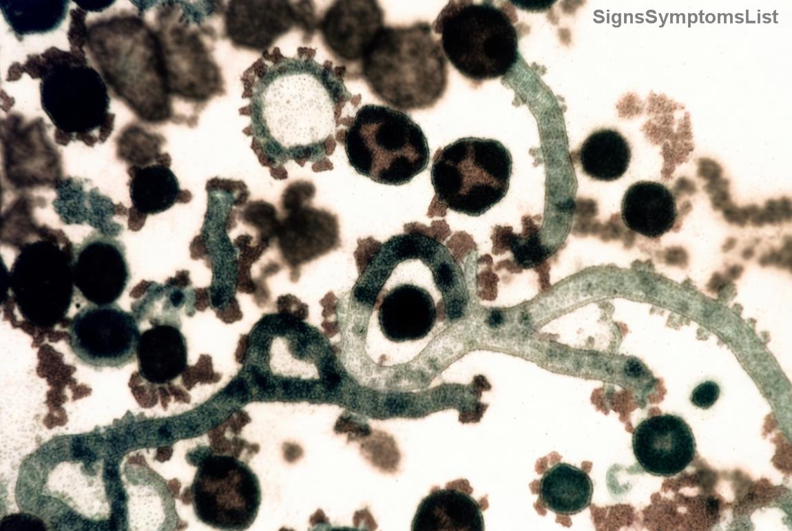 Immagine di un pasto nutriente post-tiroidectomia, con alimenti ricchi di iodio e selenio, simboleggiando benessere nutrizionale