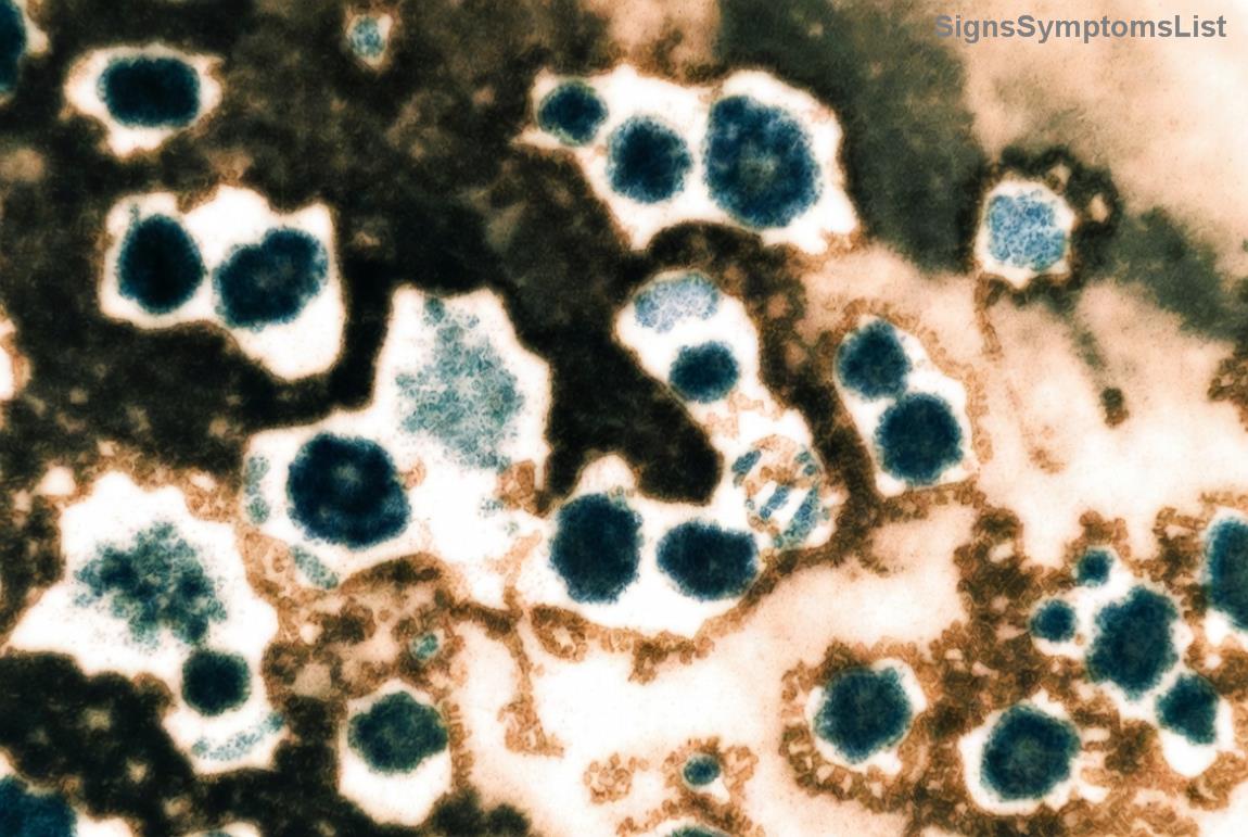 Early detection of melanoma on skin