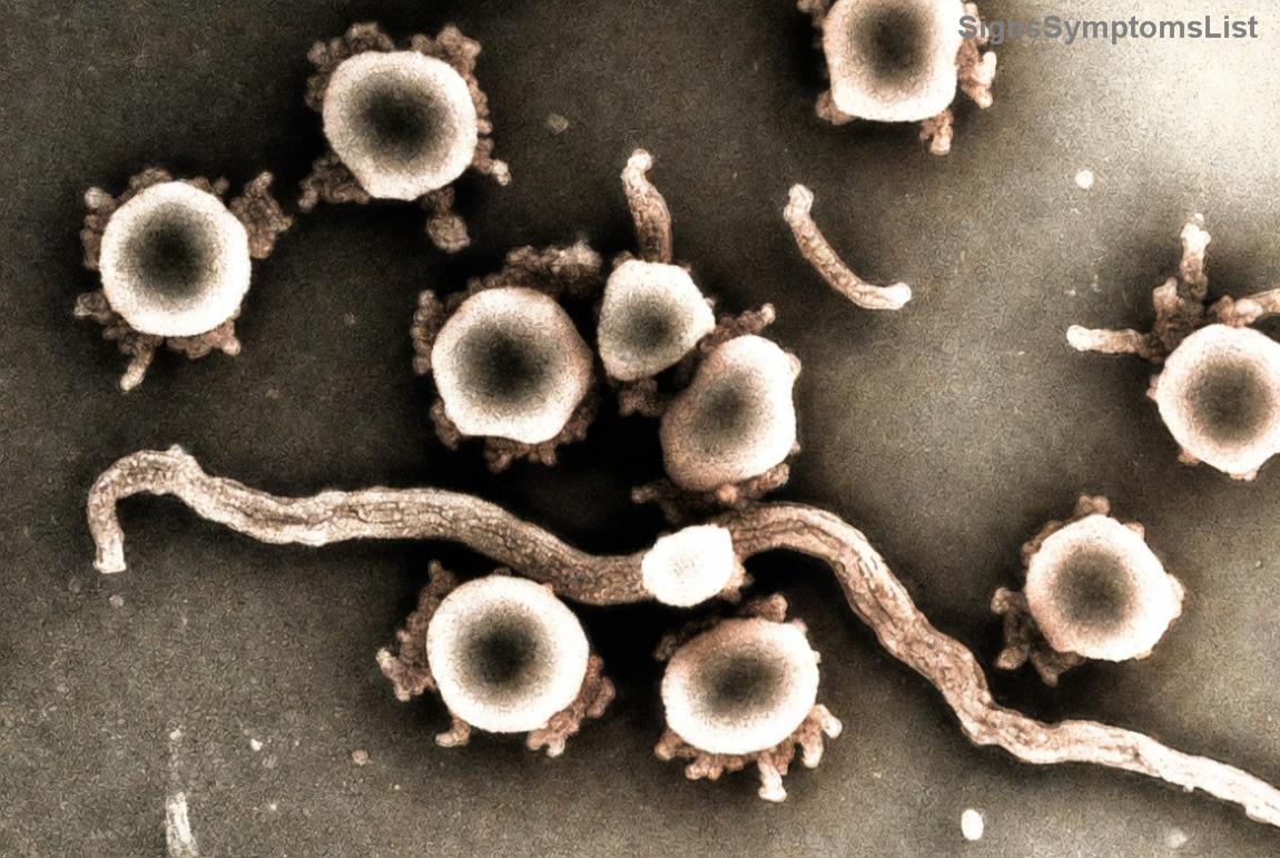 Sintomi del cancro della pelle: macchie irregolari sulla pelle