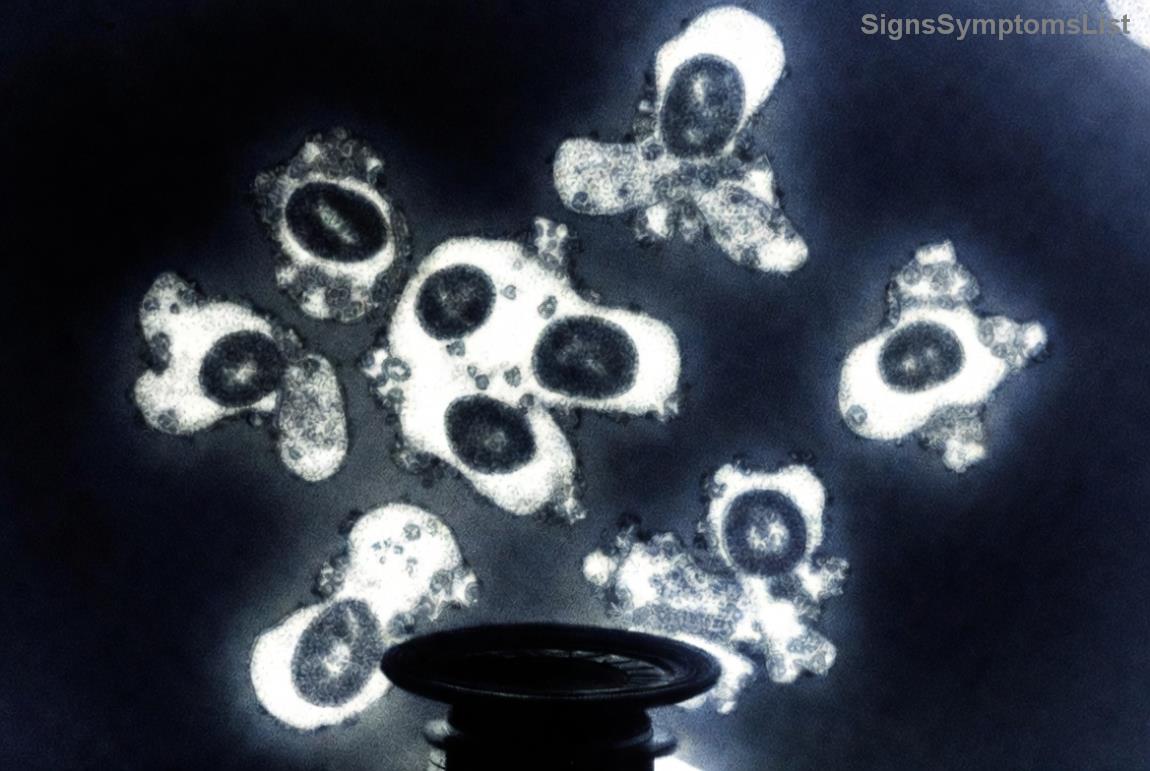 手術後の回復イメージ