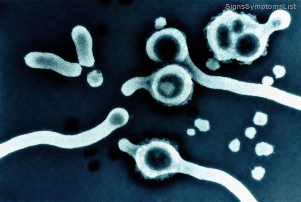 Patient in Erholung nach Nierenkrebs-Operation