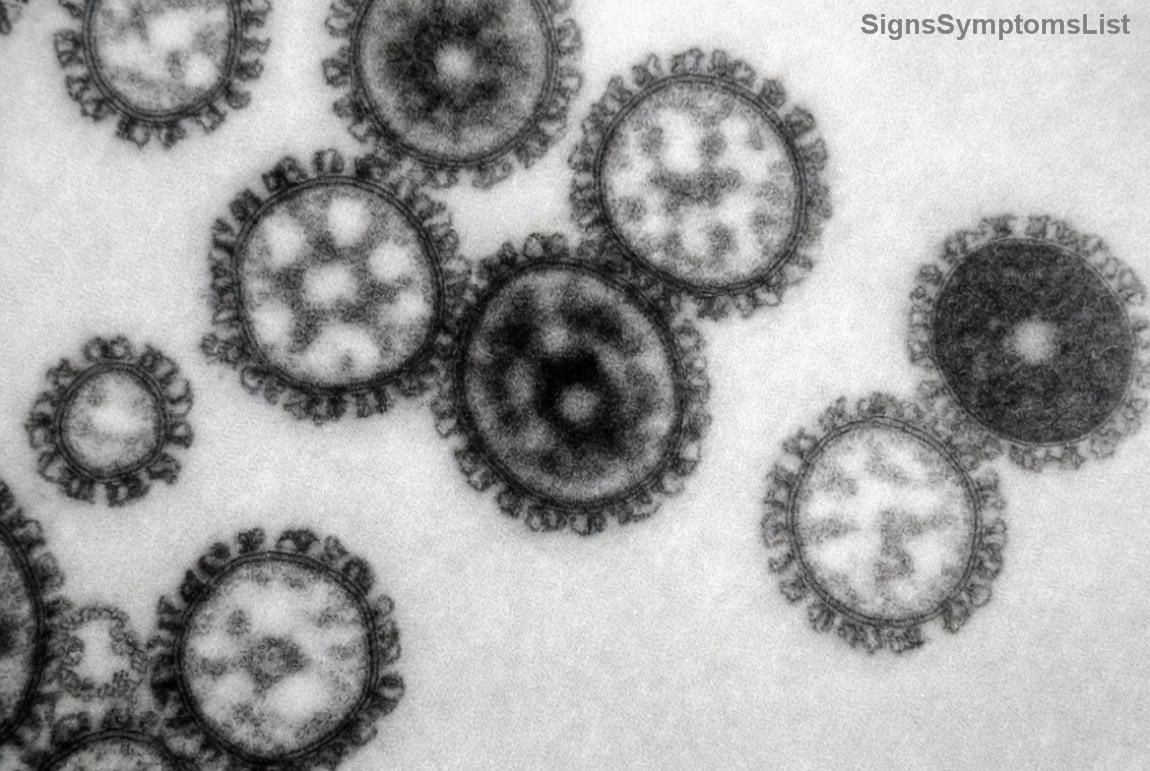 Illustration of lung anatomy highlighting cancer spread in stage 4