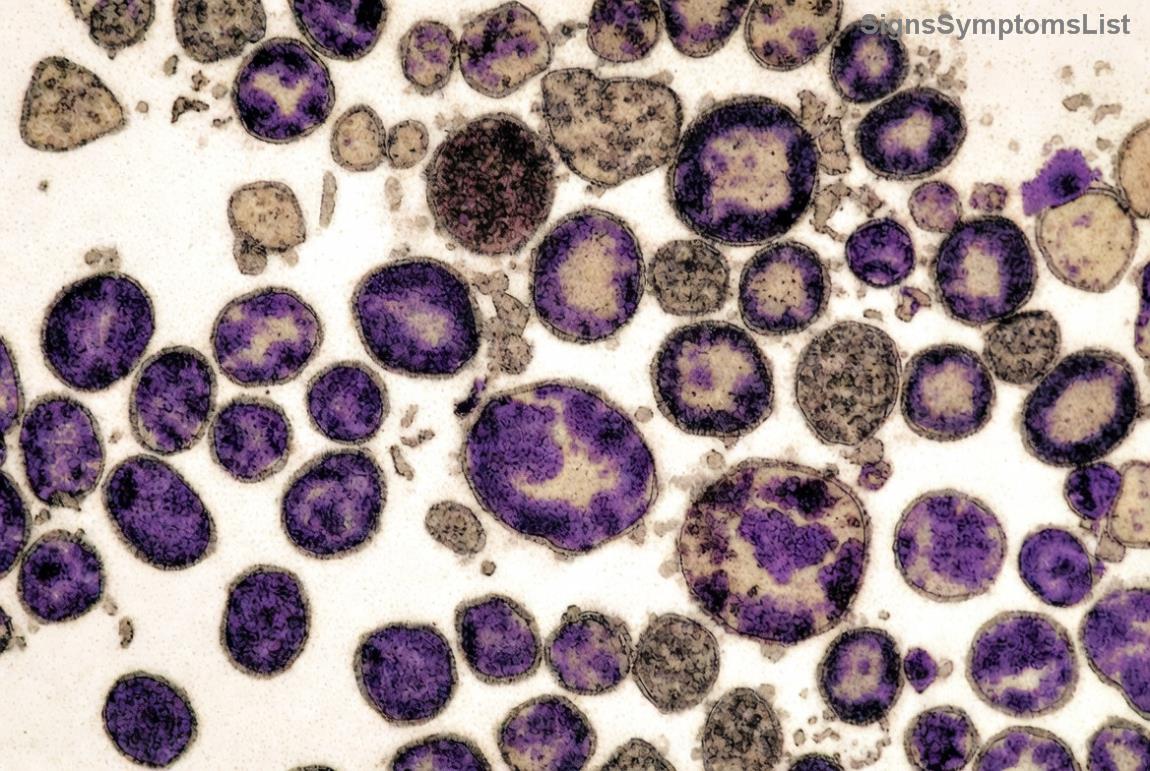 Early stage breast cancer awareness illustration showing hope and support