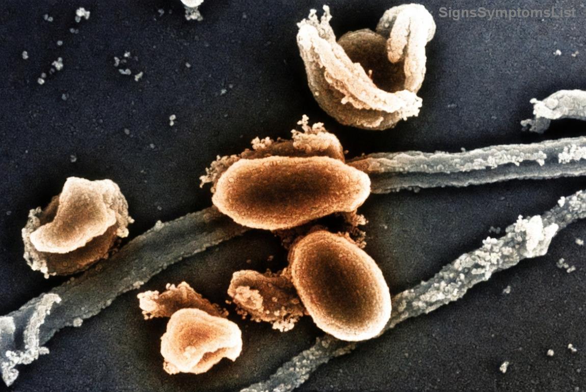 위암 수술 후 영양 관리 이미지