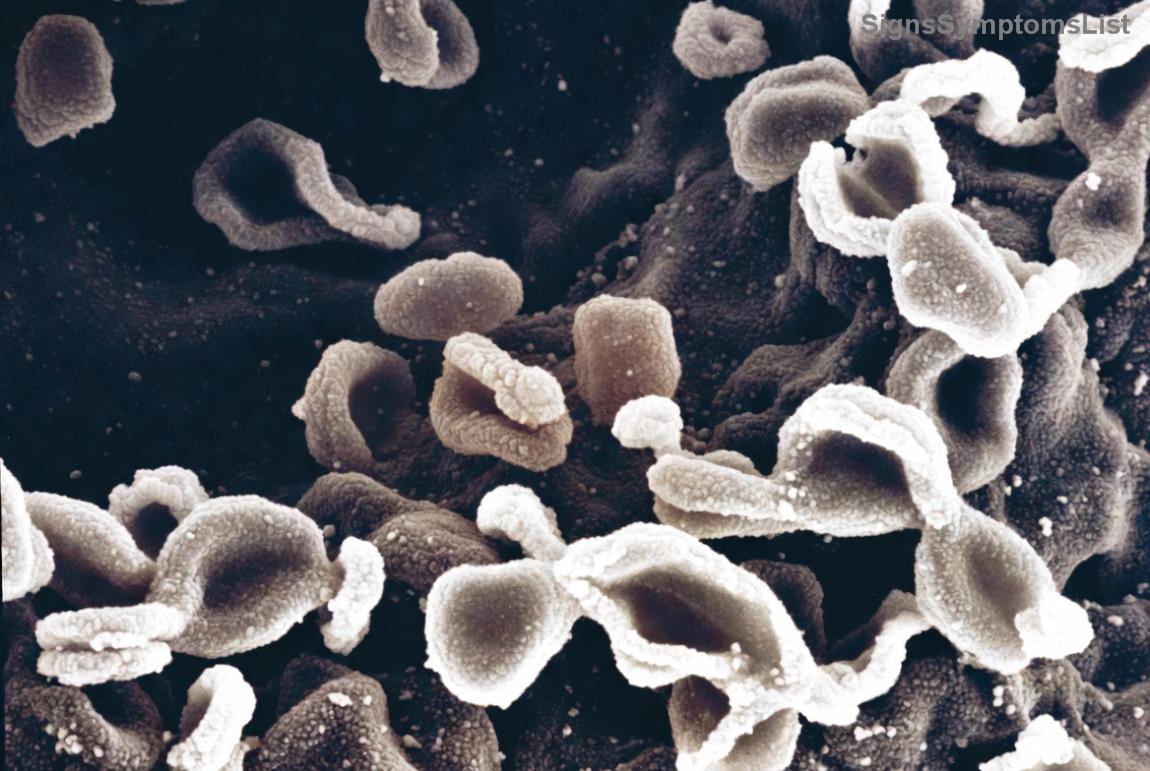 Illustrazione di cibi sani per il fegato, come verdure e frutta fresca, simboleggianti un'alimentazione consapevole contro il cancro al fegato