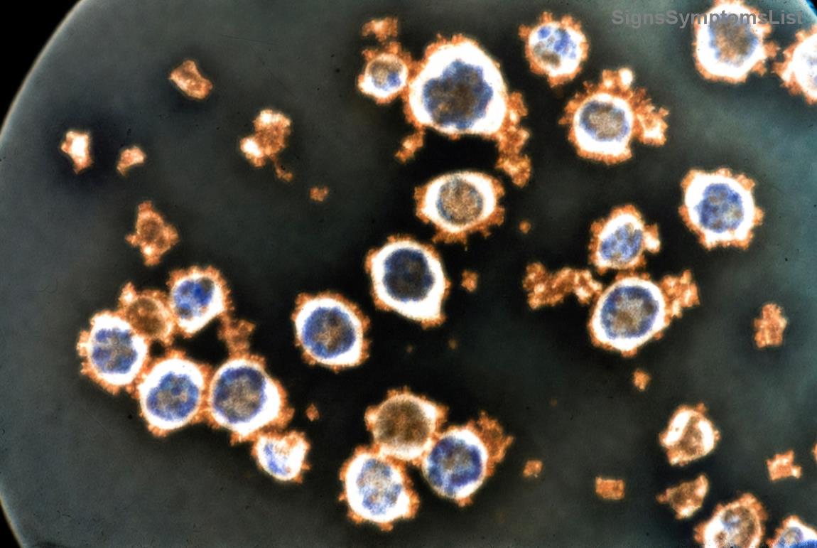 Patient using innovative glioblastoma therapy device