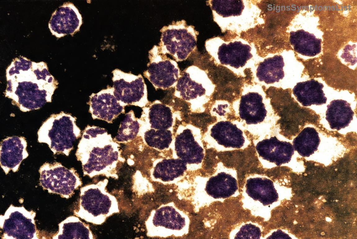 Frisches Gemüse und Obst auf einem Tisch – Symbol für gesunde Brustkrebs-Diät