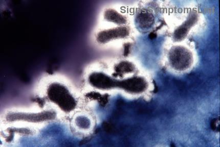 Prostata-Krebs Ernährung: 5 Superfoods für bessere Gesundheit und Erholung