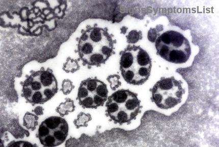 Can Metastatic Breast Cancer (Stage 4) Be Cured? Hopeful Paths to Management and Survival