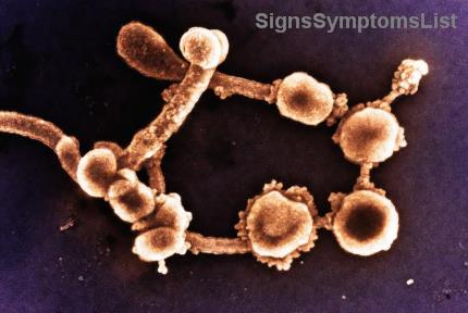 Le carcinome épidermoïde est-il guérissable aux stades précoces ? Espoir et solutions pour vaincre le cancer