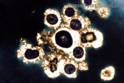 非ホジキンリンパ腫患者のための免疫力向上！最適な食事法で健康をサポート