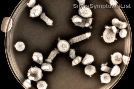 7 Superfoods Puissants pour Soutenir la Récupération du Cancer du Sein et une Santé à Long Terme