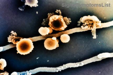 Is Metastatische Prostaatkanker Geneesbaar? Ontdek de Laatste Inzichten en Hoopvolle Opties