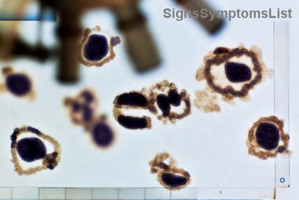 Leukämie-Diät: Sichere Ernährungstipps für immungeschwächte Patienten – Ihr Weg zu mehr Wohlbefinden