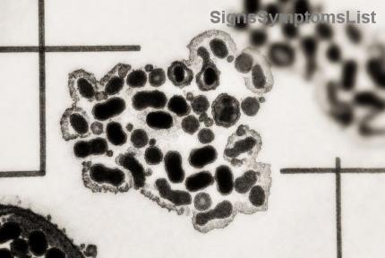 Blasenkanker Dieet: Hydratatie en Voedingsmiddelen voor een Gezonde Blaas – Ontdek Effectieve Tips!