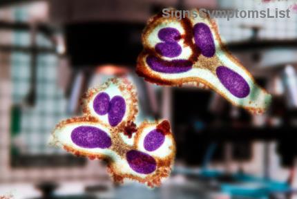 ¿Es Curable el Cáncer Colorrectal en Etapas 1 y 2 Después de la Cirugía? Esperanza y Resultados Reales