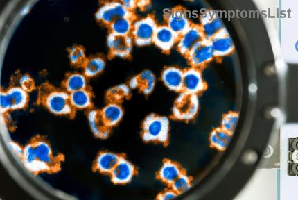 Leukemie Dieetgids: Veilige Eetgewoonten voor Immuungecompromitteerde Patiënten – Jouw Weg naar Betere Gezondheid