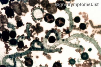 Esophageal Cancer Diet Guide: Soft Foods & Swallowing Tips to Boost Nutrition