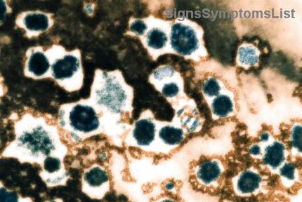 Can Advanced Metastatic Kidney Cancer Be Cured? Hopeful Insights and Real Solutions