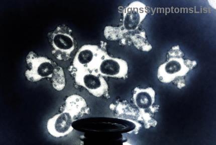 Can Advanced-Stage Hodgkin Lymphoma Be Cured? Hopeful Insights for Patients and Families