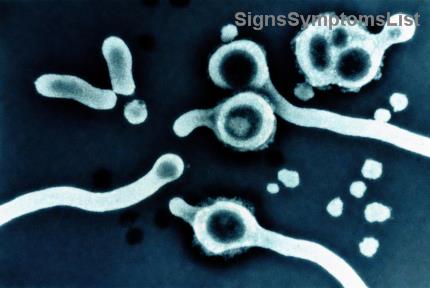 Indolent Non-Hodgkin Lymphoma: Can Slow-Growing NHL Be Cured or Effectively Treated?