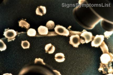 Can Stage 4 Colorectal Cancer Be Cured If It Spreads to the Liver? Hopeful Insights and Real Solutions