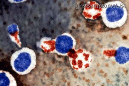 ステージ1・2大腸がんの手術後、完治は可能？希望に満ちた最新の真実を明らかに