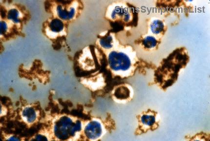 Small Meals, Big Energy: Proven Eating Strategies to Boost Vitality for Pancreatic Cancer Patients