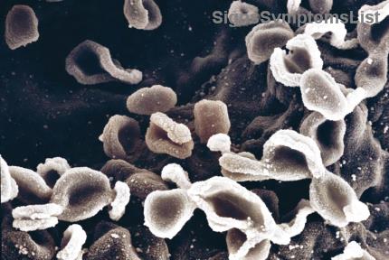 ステージ1・2の乳がんは完治する？早期発見で希望の光を掴む最新ガイド