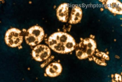 Il Melanoma di Stadio 4 è Curabile con lImmunoterapia? Scopri le Speranze e le Soluzioni Attuali