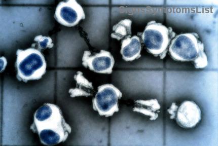 Câncer de Tireoide Anaplásico Curável? Descubra Esperanças e Tratamentos Inovadores