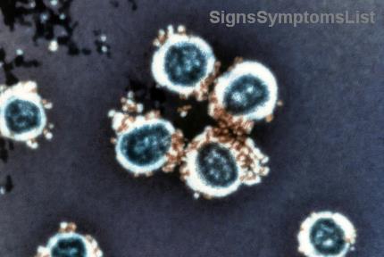 Tumeurs Cérébrales de Bas Grade : Sont-Elles Guérissables ? Espoir et Solutions Modernes