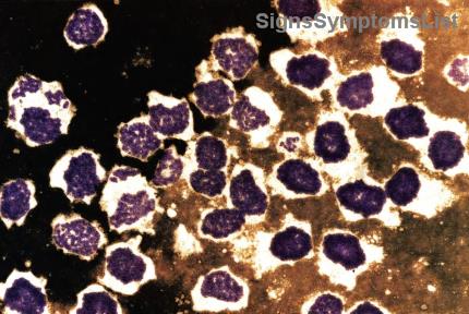 Debunking Lung Cancer Diet Myths: The Truth About Sugar, Antioxidants, and Your Path to Better Health