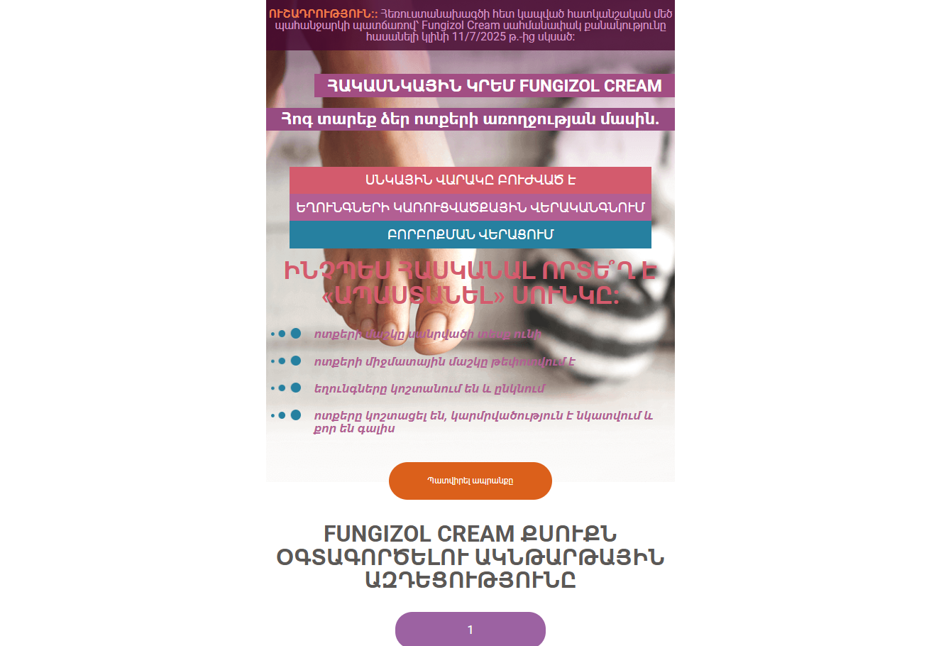Fungizol product image showing cream application
