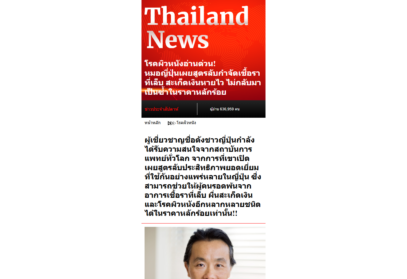 ภาพผลิตภัณฑ์ Elsie