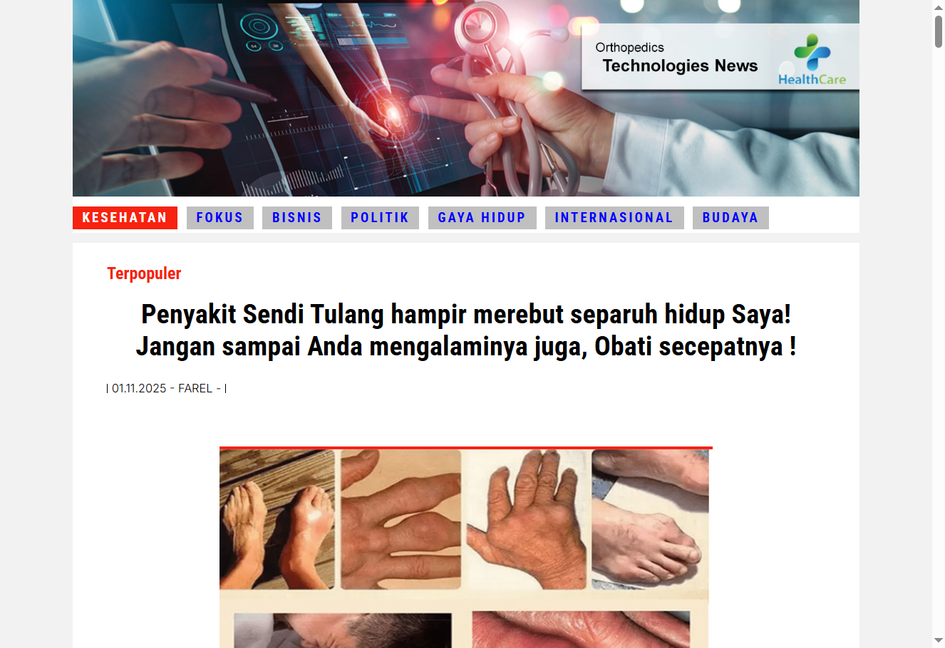 Gambar Flexamove untuk kesihatan sendi