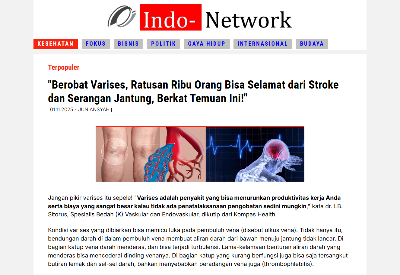 Gambar Varicozy untuk rawat urat saraf