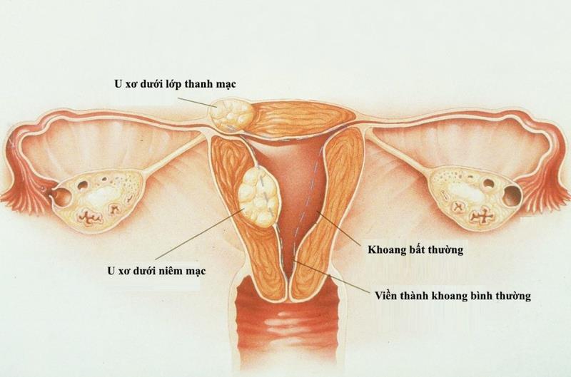 Is cervical nabothian cyst a dangerous disease?  Causes and treatments