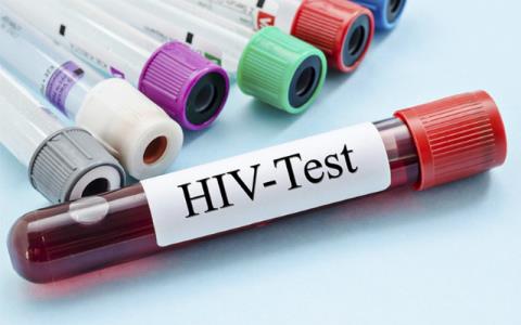 Ответ: Точны ли результаты теста на ВИЧ через 3 месяца?